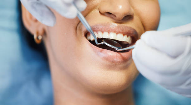 Best After-Hours Emergency Dentist in Locust Grove, OK