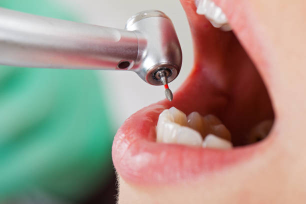 Best Pediatric Emergency Dentist in Locust Grove, OK